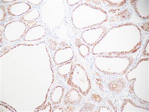 3184A | Control Slides:Immunopathology; CD56